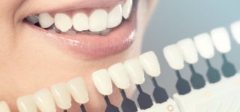 How to Choose the Best Cosmetic Dentist?
