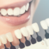 How to Choose the Best Cosmetic Dentist?